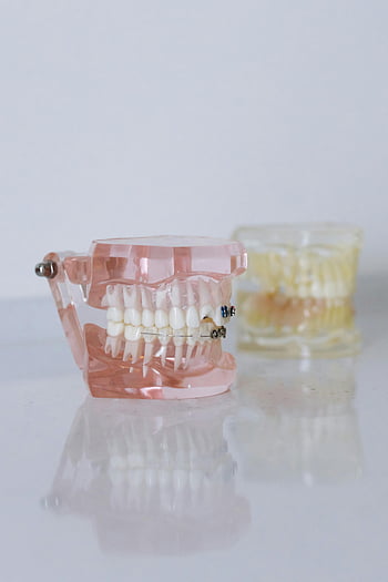 dentures, dental model, braces, orthodontic equipment, close-up shot, detailed view, dental care, orthodontics, teeth model, dental appliance, dental health