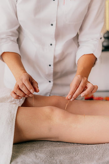 acupuncture, knee treatment, professional acupuncturist, indoor therapy, close-up, needle therapy, alternative medicine, knee acupuncture, health treatment, wellness, traditional medicine