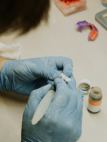 dental implant, dental technician, prosthetic materials, clinic, close-up, specialist, gloves, dental work, prosthetics, dental clinic, dental procedure