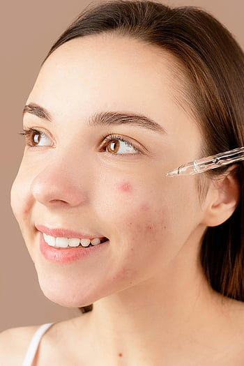 Wanita Menerapkan Serum Wajah, Serum pengobatan jerawat, wanita muda yang tersenyum, perawatan kulit wajah, perawatan kulit rutin, perawatan kecantikan, perawatan wajah, produk perawatan kulit, serum wajah, pengobatan jerawat, Manfaat perawatan kulit