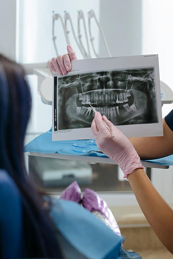 fogorvos, röntgen, fogászati ​​röntgen, türelmes, klinikai környezet, fogápolás, szájhigiéné, fogászati ​​vizsgálat, fogorvosi szakember, fogászati ​​Klinika, fogászati ​​képalkotás