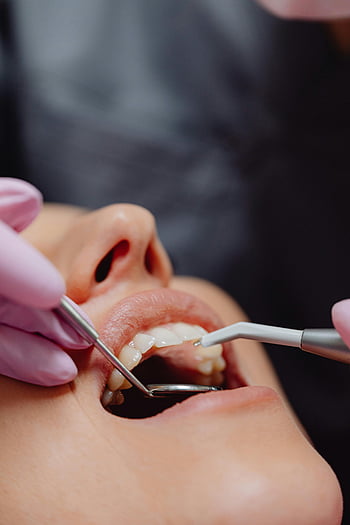 zubní postup, trpělivá péče, dentální hygiena, detail, dentální nástroje, zubař, zubní ošetření, orální zdraví, Zubní vyšetření, Péče o zuby, rukavice