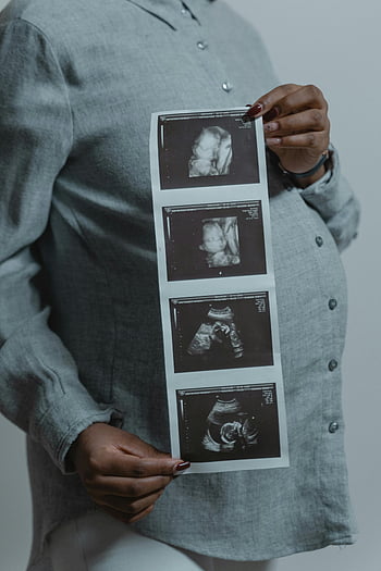 pregnant woman, ultrasound images, motherhood, new life, ultrasound scans, pregnancy, baby, expectant mother, medical imaging, fetal development, maternity