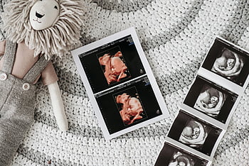 ultrasound results, pregnant woman, baby ultrasound, lion stuffed toy, knitted rug, prenatal care, ultrasound printout, pregnancy, fetal development, baby scan, expectant mother