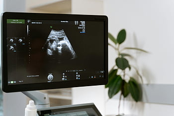 ultrasound testing, medical ultrasound, fetus scan, clinic setting, ultrasound monitor, medical imaging, prenatal ultrasound, ultrasound machine, ultrasound display, fetal ultrasound, clinic environment