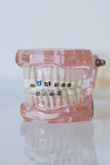 dentures, braces, dental model, close-up shot, clinical setting, teeth, orthodontics, dental appliance, dental care, dental health, dental equipment