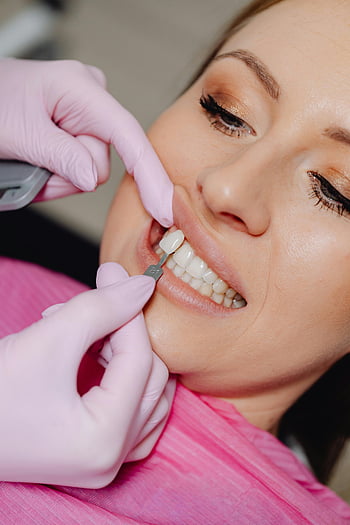 zubař, zub dýhy, zubní postup, ženské zuby, Péče o zuby, zubní dýha, zubní ošetření, zubní klinika, dentální hygiena, Zubní profesionál, Zubní práce